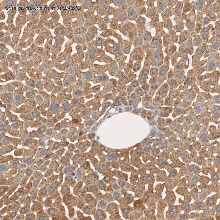 HUABIO HA751592 image 2