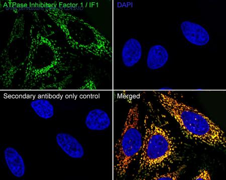 HUABIO HA751608 image 2