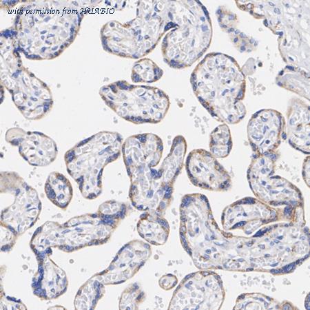 HUABIO HA751616 image 3