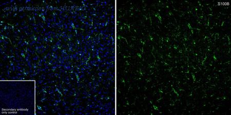 HUABIO HA751617 image 1