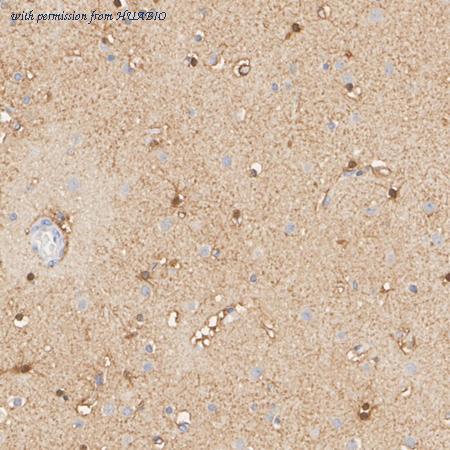 HUABIO HA751617 image 2