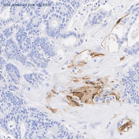 HUABIO HA751617 image 3