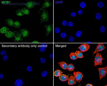 HUABIO HA751624 image 3