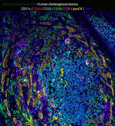 HUABIO IRS004 image 1