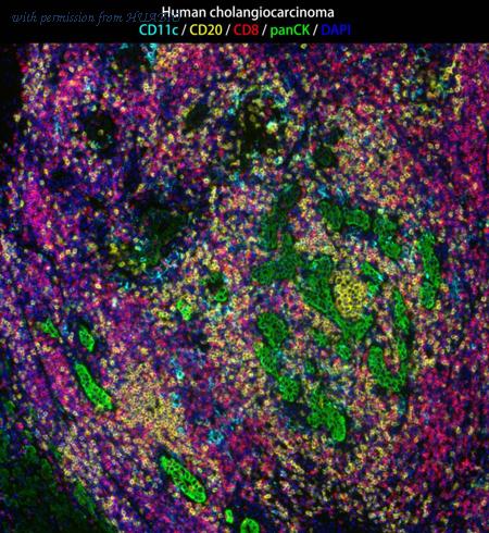 HUABIO IRS010 image 1