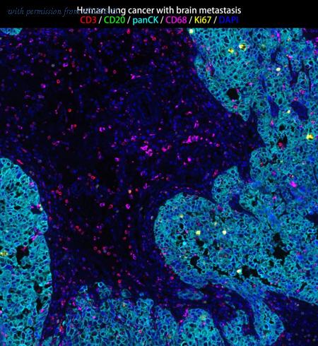 HUABIO IRS010 image 3