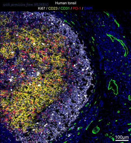 HUABIO IRS021 image 1