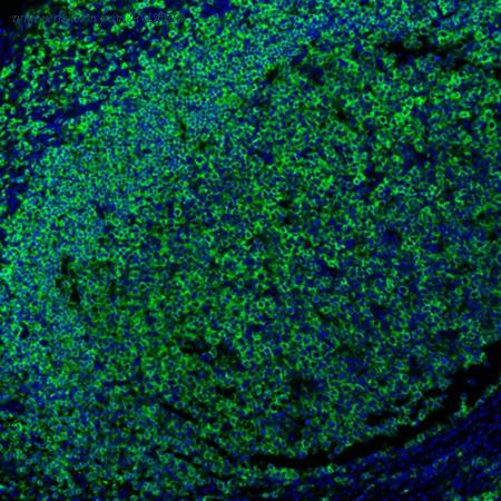 HUABIO IRS035 image 1