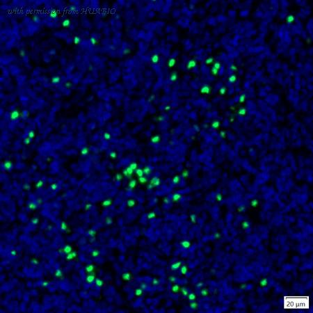 HUABIO IRS047 image 1