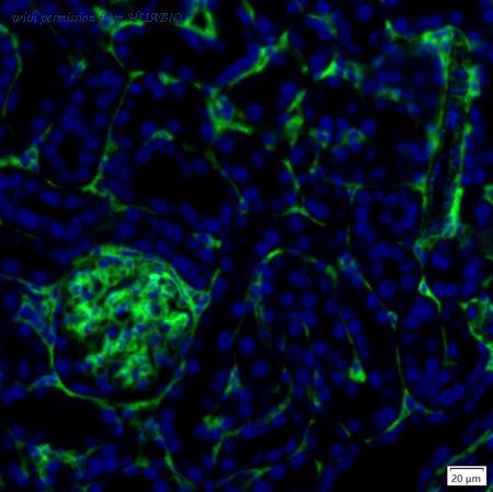 HUABIO IRS058 image 3