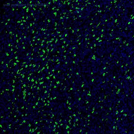 HUABIO IRS062 image 2