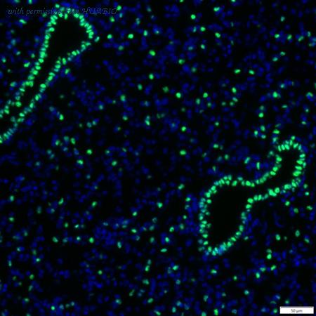 HUABIO IRS063 image 2