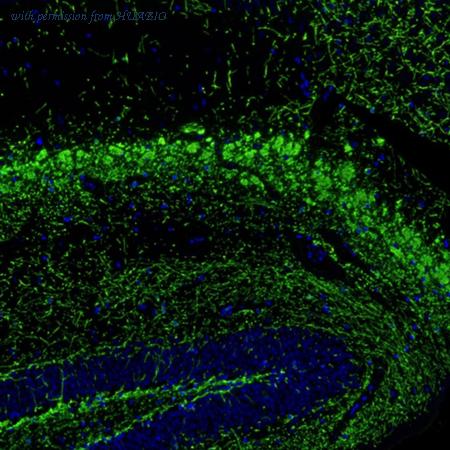 HUABIO IRS064 image 1