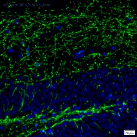 HUABIO IRS064 image 2