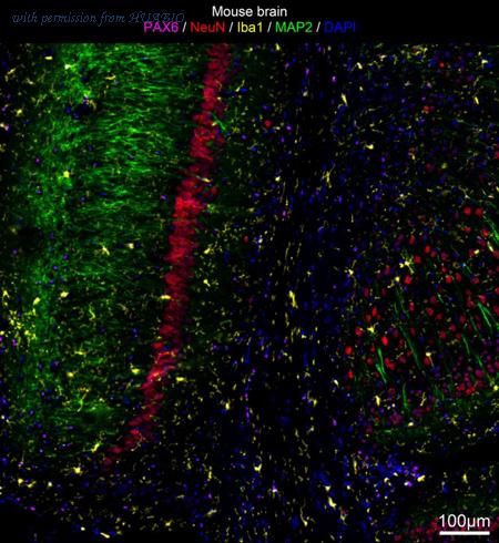 HUABIO IRS066 image 1