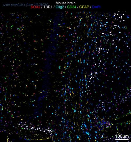 HUABIO IRS069 image 1