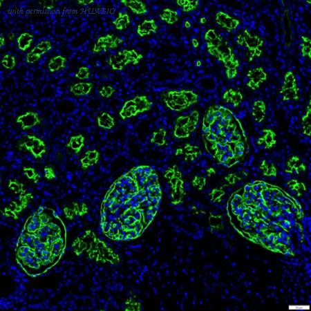 HUABIO IRS101MS image 1