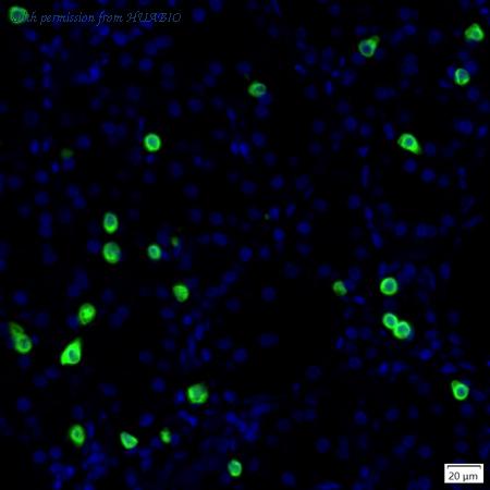 HUABIO IRS149RB image 1