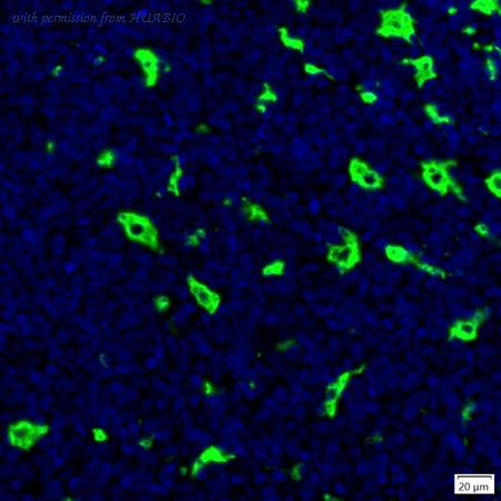 HUABIO IRS156RB image 1