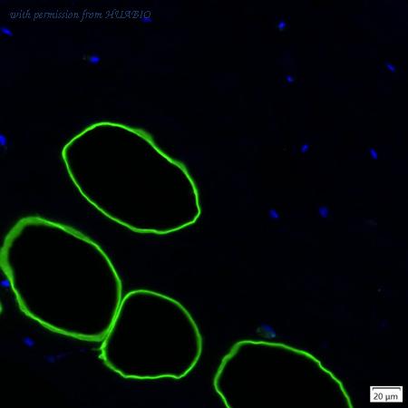 HUABIO IRS157RB image 1