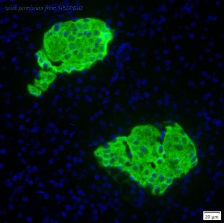 HUABIO IRS161RB image 1