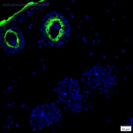 HUABIO IRS165RB image 1