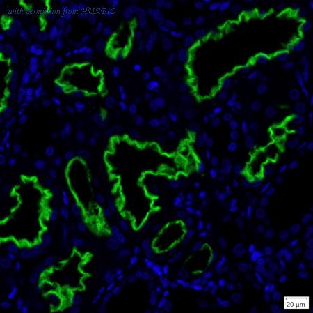 HUABIO IRS213RB image 3