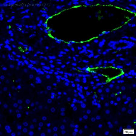 HUABIO IRS215RB image 1