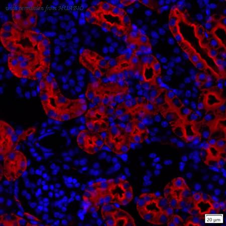 HUABIO IRS218RB image 1