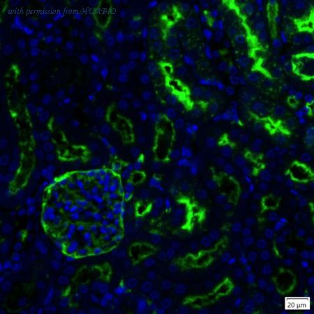 HUABIO IRS222MS image 1