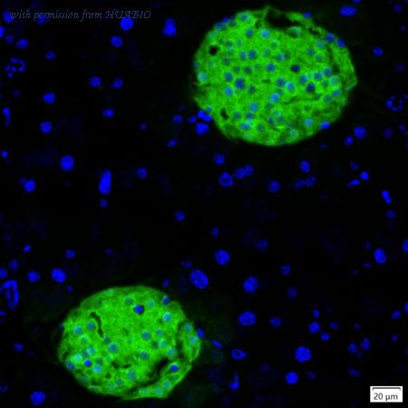 HUABIO IRS233RB image 1