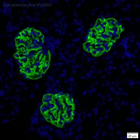 HUABIO IRS237RB image 1