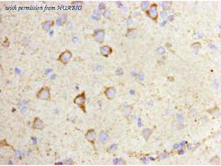 HUABIO M1007-10 image 2