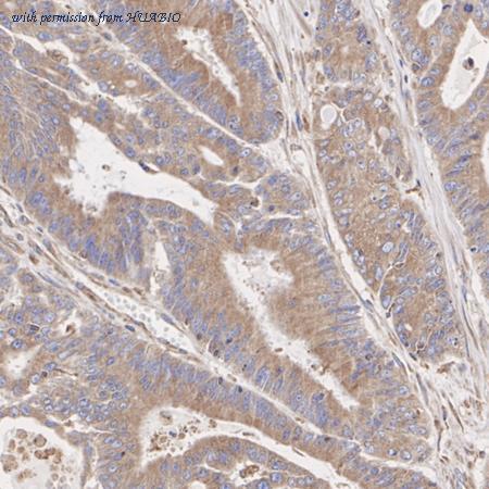 HUABIO M1009-1 image 1