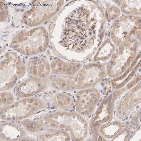 HUABIO M1009-1 image 2