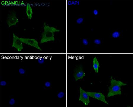 HUABIO M1010-3 image 2
