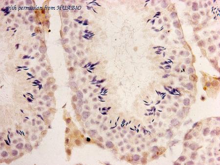 HUABIO M1210-1 image 2