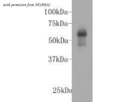 HUABIO M1210-6 image 1