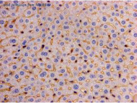 HUABIO M1211-4 image 2