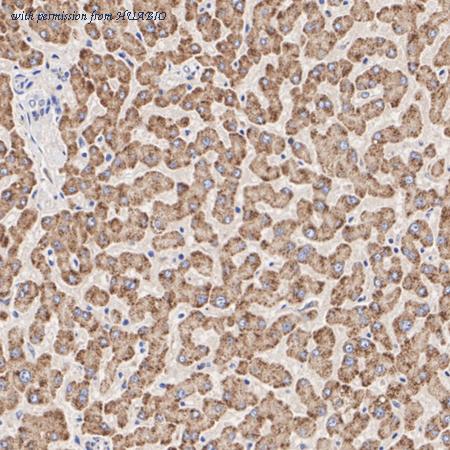 HUABIO M1306-1 image 2