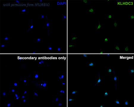 HUABIO M1310-1 image 1