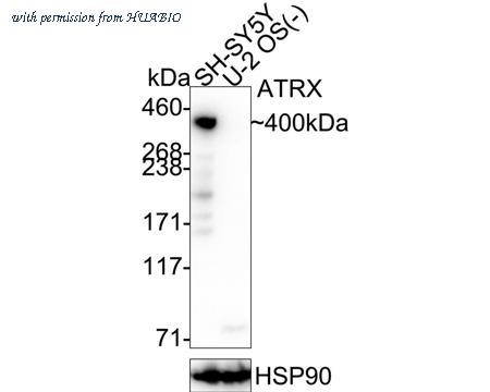 HUABIO M1311-2 image 1