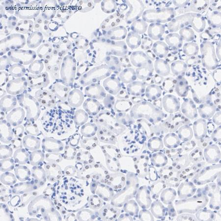 HUABIO M1311-2 image 3