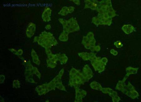 HUABIO M1403-1 image 2