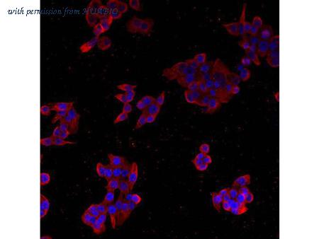 HUABIO M1403-5 image 1