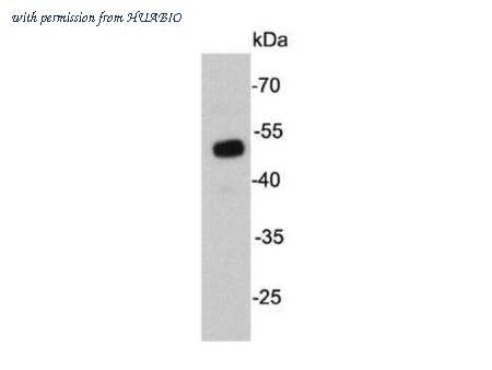 HUABIO M1407-6 image 1