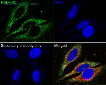 HUABIO M1409-2 image 3
