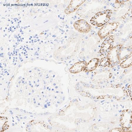 HUABIO M1412-2 image 2