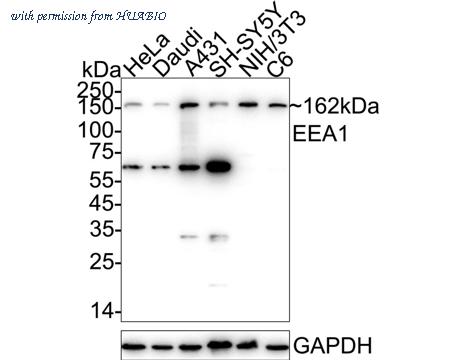 HUABIO M1503-1 image 2