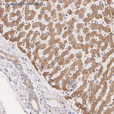 HUABIO M1506-2 image 2